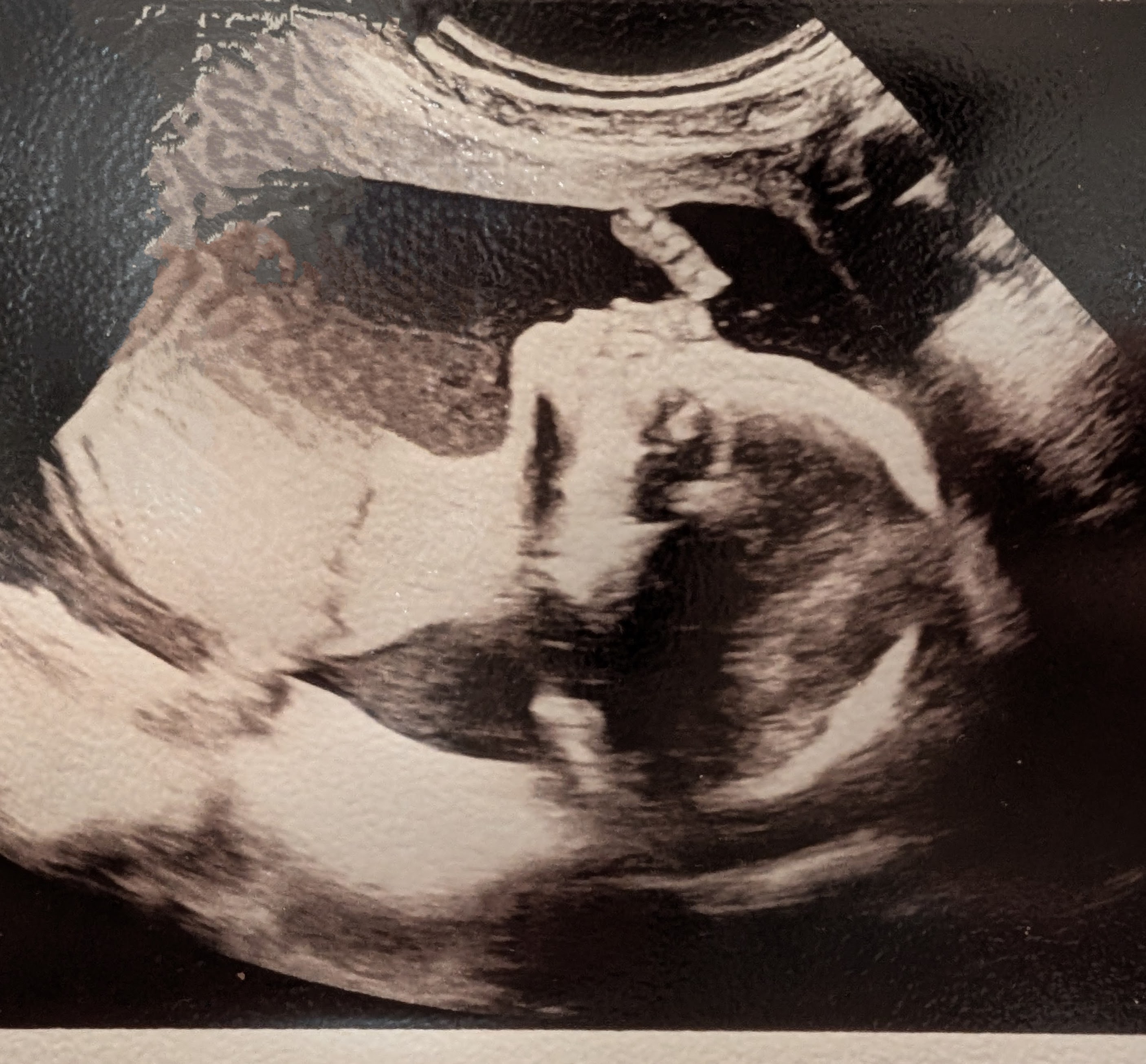 Pemi touching his nose