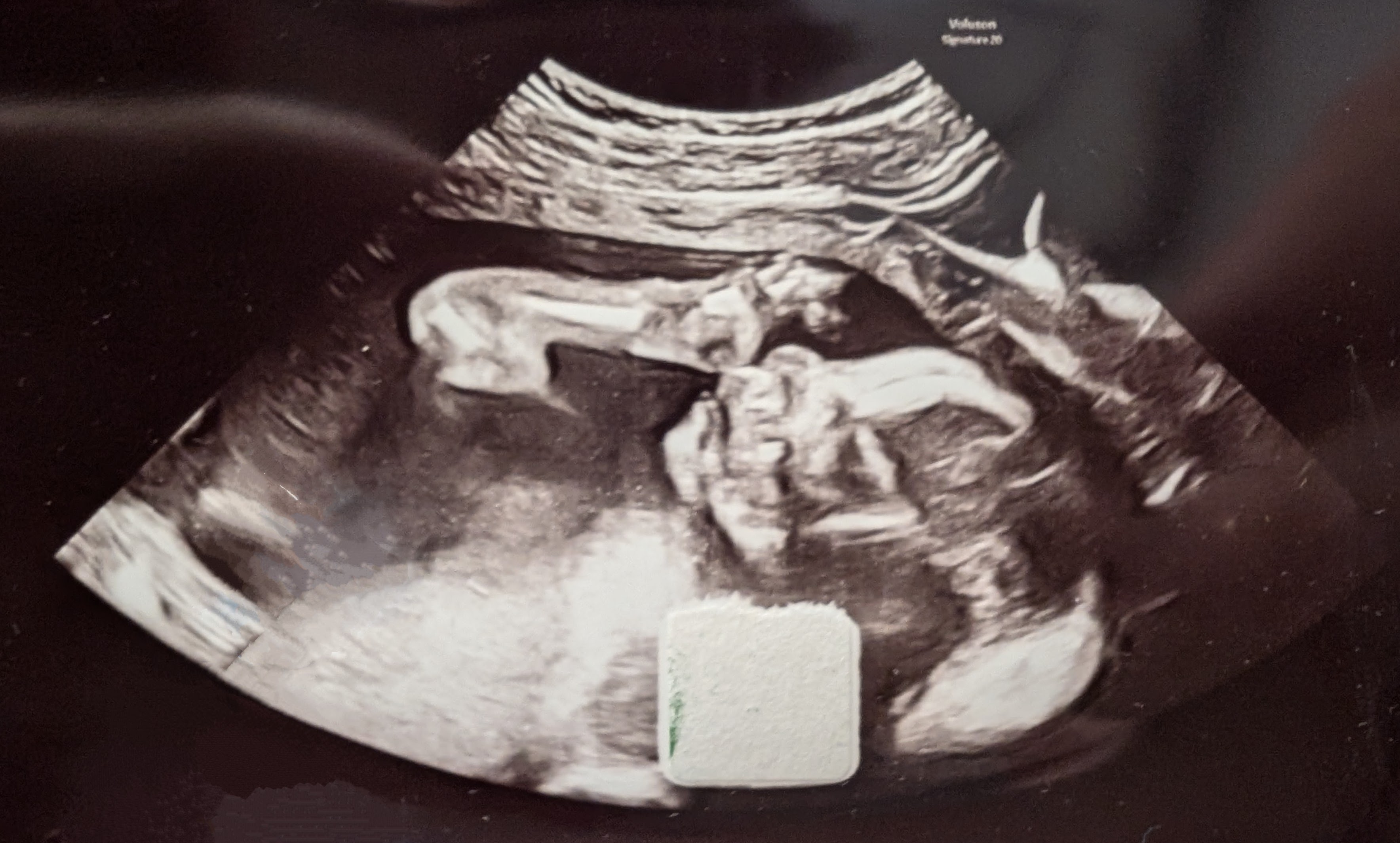 He's a bit less tiny!